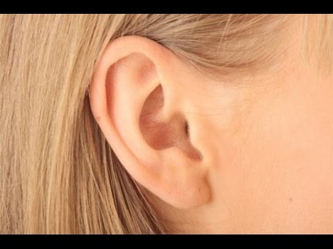 Formas de la oreja