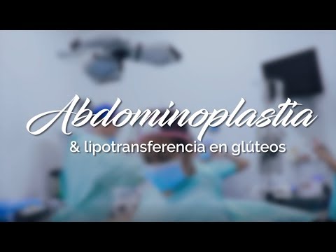 Abdominoplastia con transferencia glutea